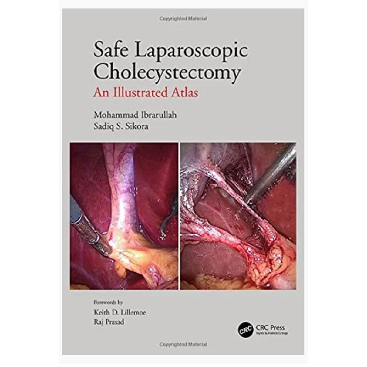 Safe Laparoscopic Cholecystectomy: An Illustrated Atlas