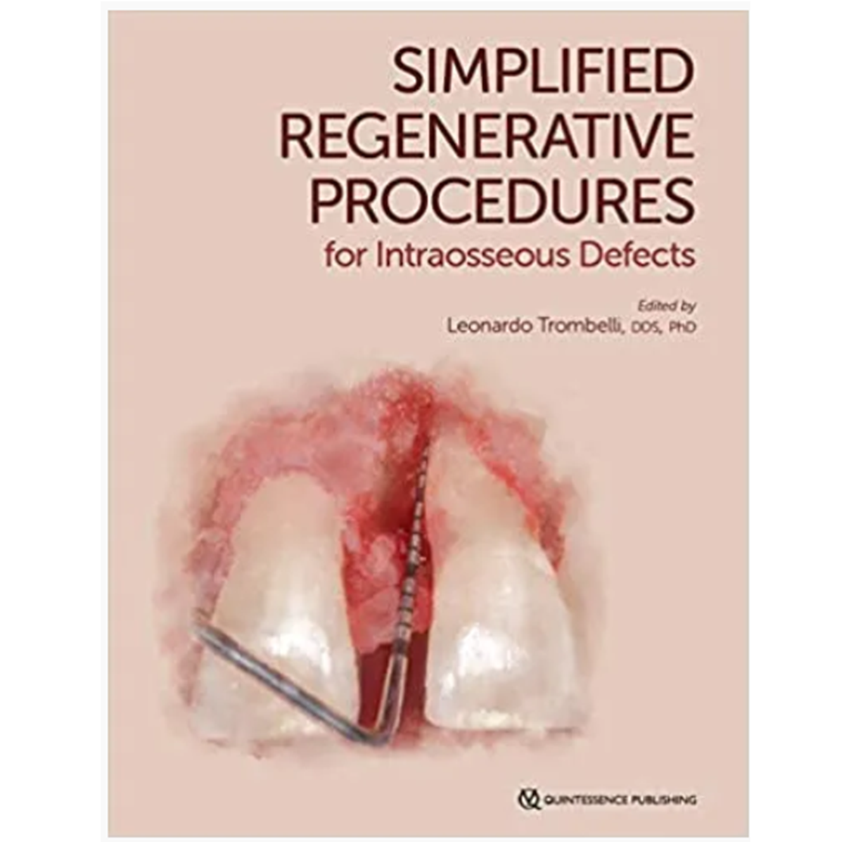 Simplified Regenerative Procedures for Intraosseous Defects