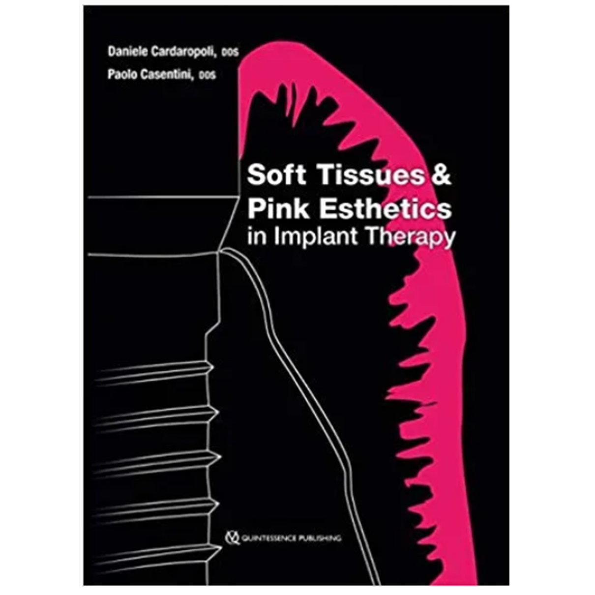 Soft Tissues & Pink Esthetics in Implant Therapy