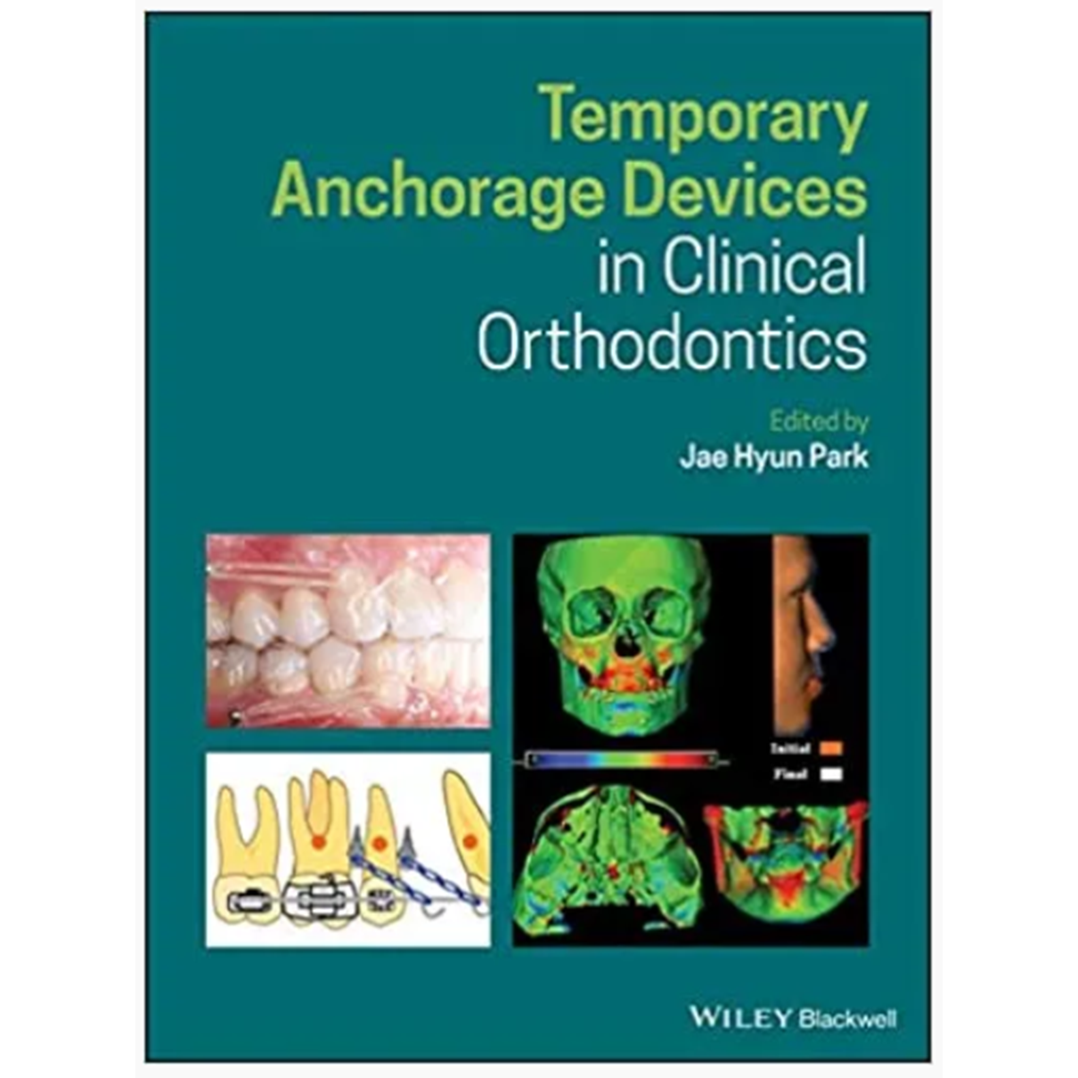 Temporary Anchorage Devices in Clinical Orthodontics