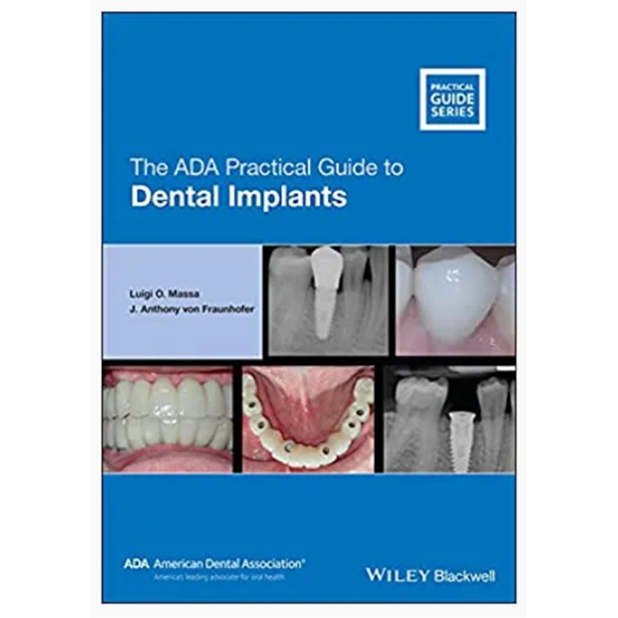 The ADA Practical Guide to Dental Implants