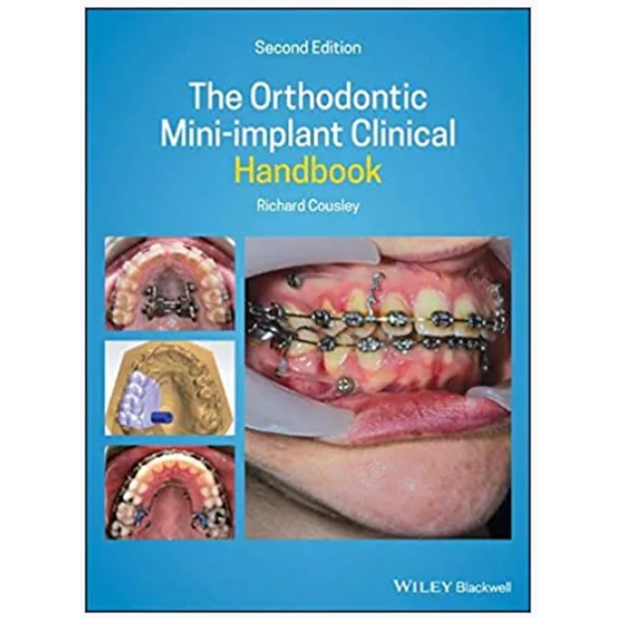 The Orthodontic Mini-implant Clinical Handbook